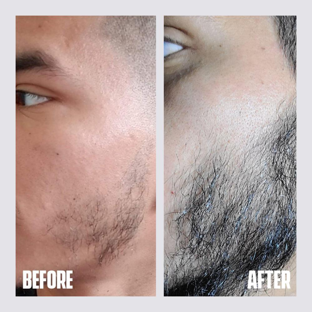 Dr. Alies Professional Beard Growth Oil