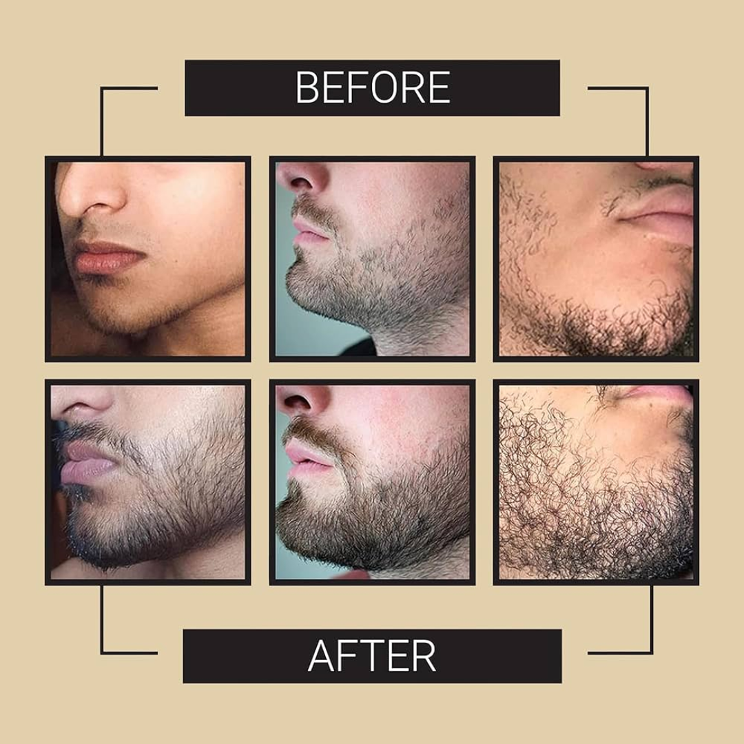 Dr. Alies Professional Beard Growth Oil