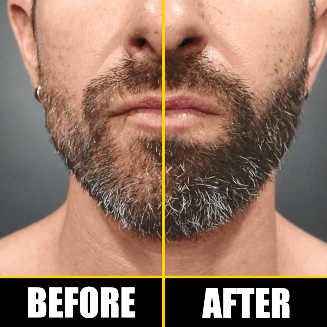Dr. Alies Professional Beard Growth Oil