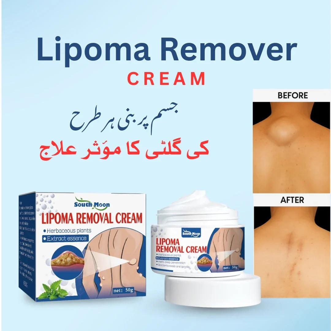 LIPOMA REMOVAL CREAM(IMPORTED)