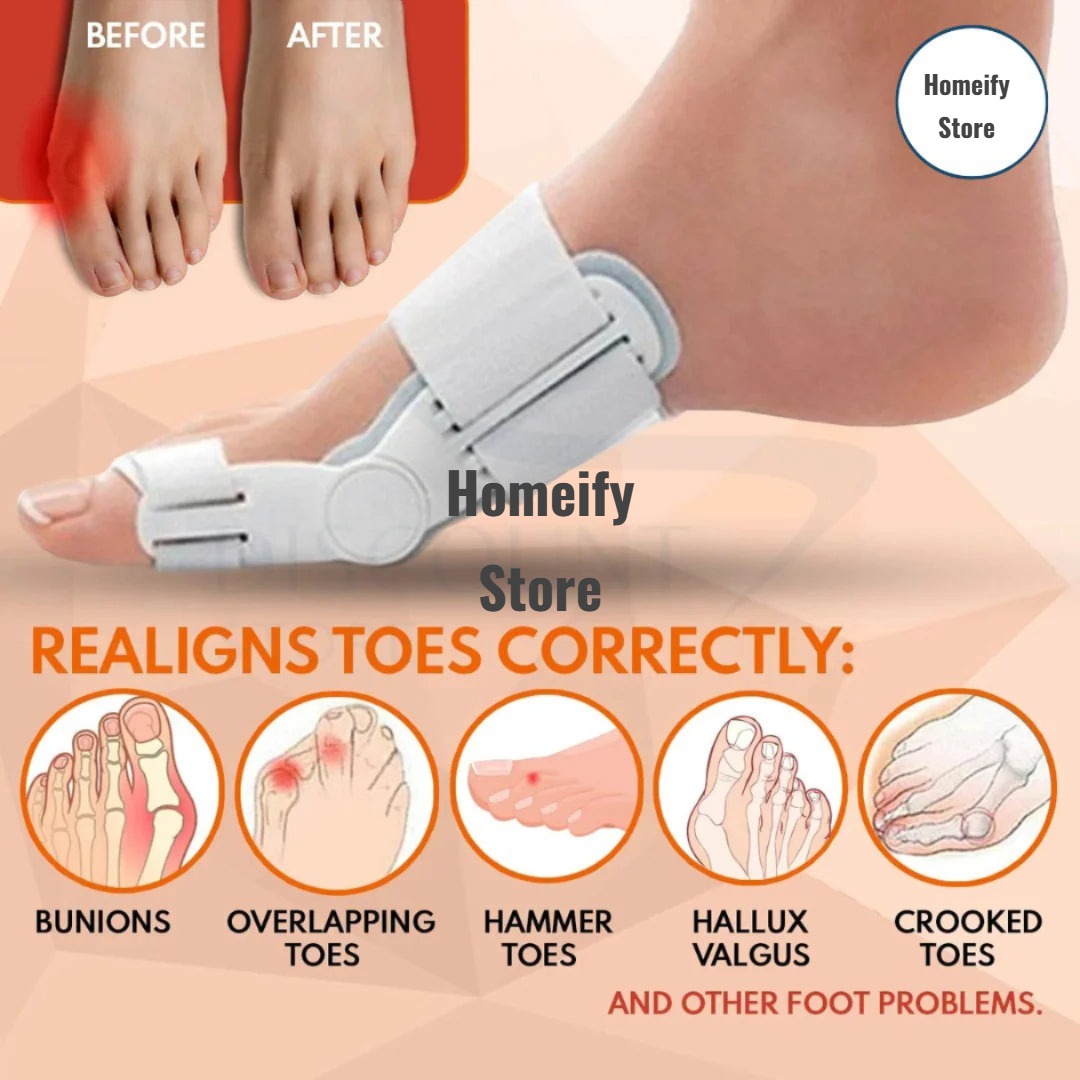 Pain Relief Bunion Toe Corrector - (IMPORTED W/O KNOB)